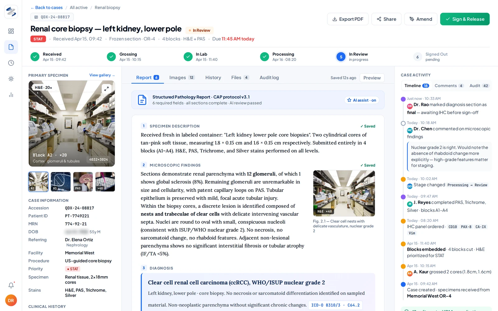 QDxPathology — case detail view with patient info, specimen classification, and pathologist report authoring